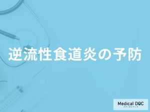 「逆流性食道炎を予防」するために「避けた方がよい飲食物」はご存知ですか？【医師監修】