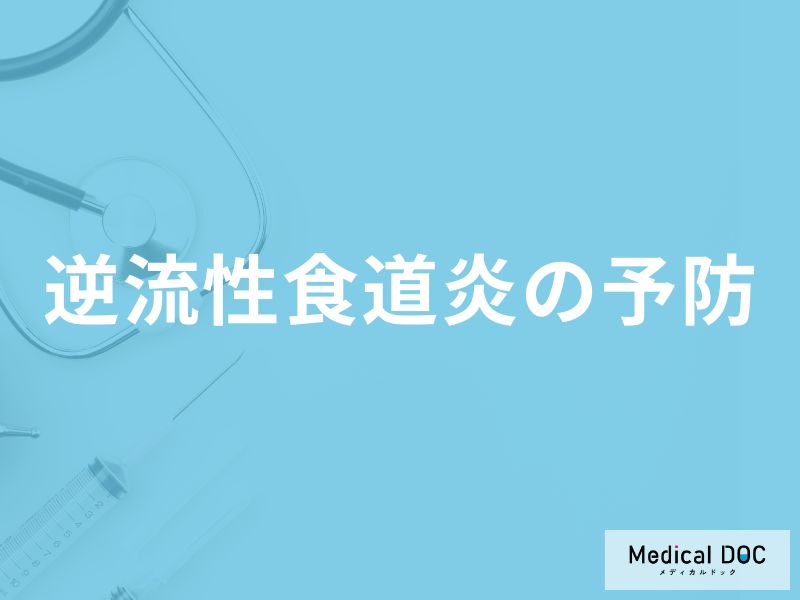 「逆流性食道炎を予防」するために「避けた方がよい飲食物」はご存知ですか？【医師監修】