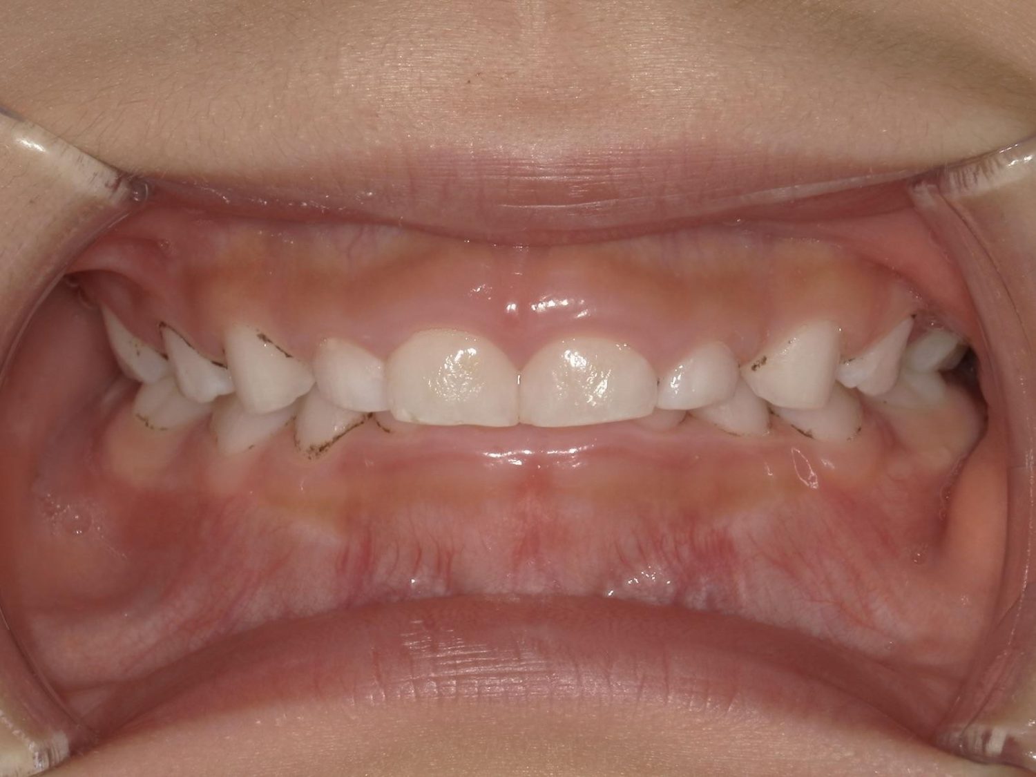 なないろこども歯科