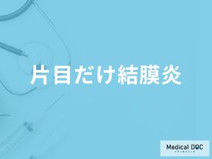 「片目だけ結膜炎」になる原因はご存知ですか？日常生活での注意点も解説！【医師監修】