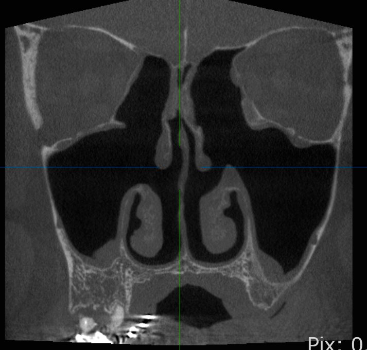 そしがや駅前耳鼻咽喉科クリニック