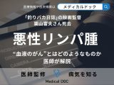 ｢釣りバカ日誌｣の監督・栗山富夫さん死去 血液のがん『悪性リンパ腫』を医師が解説