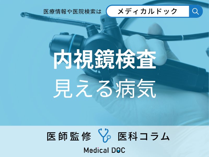 内視鏡検査 見える病気