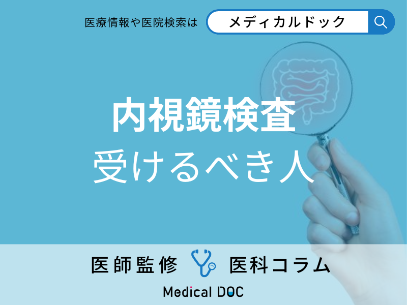 内視鏡検査 受けるべき人