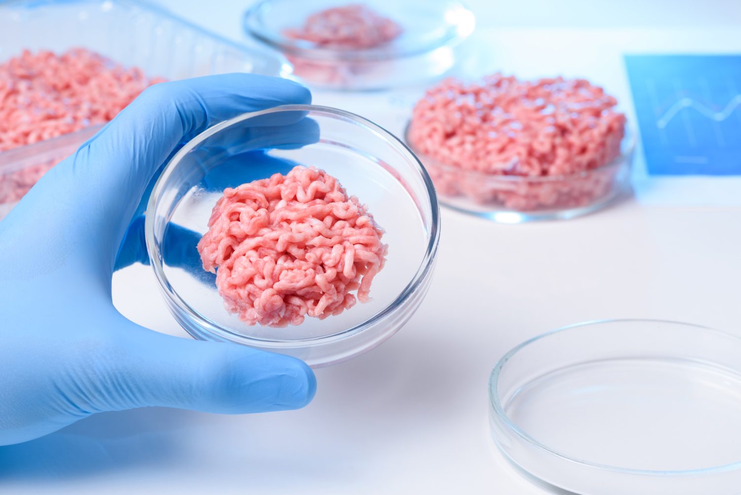 「大腸がんの発症リスクが高い食事」をご存じですか？ 大腸がんと赤身肉・加工肉の関連を医師に聞く