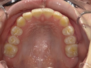 チャイルドしかハウス