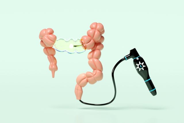 大腸内視鏡検査とは? 医師が解説
