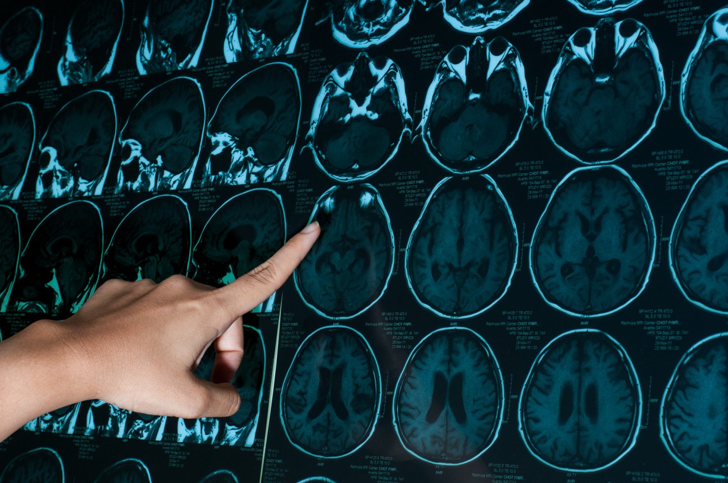 命に関わる可能性がある「危険なめまい」とは？