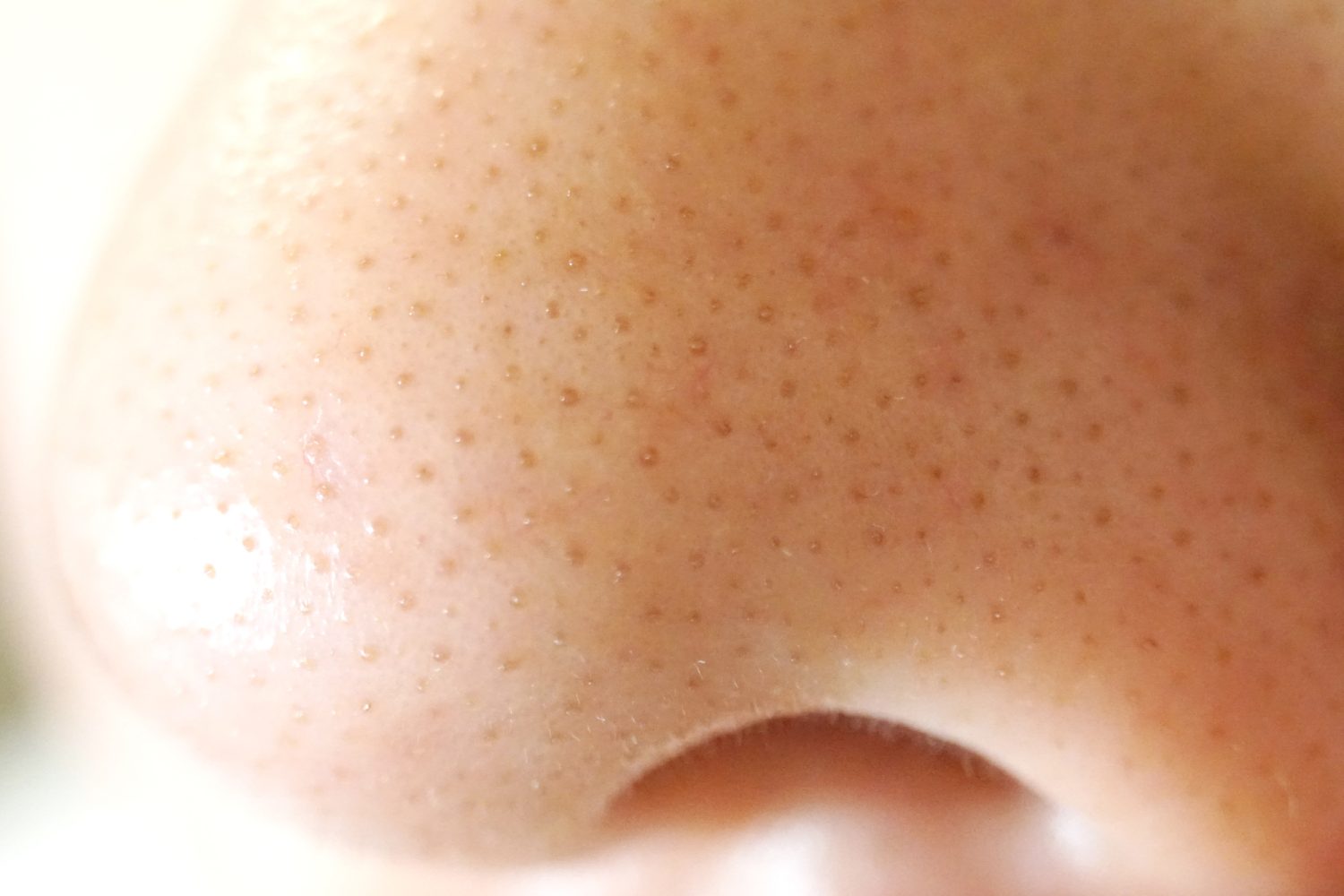 気になる「毛穴」、なぜ目立つの？