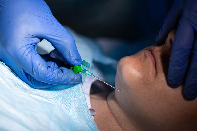 施術の種類について【HIFU・脂肪吸引・ヒアルロン酸注入など】