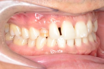 桜新町グリーン歯科・矯正歯科