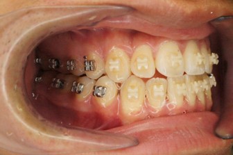 桜新町グリーン歯科・矯正歯科