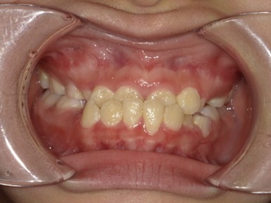 チャイルドしかハウス