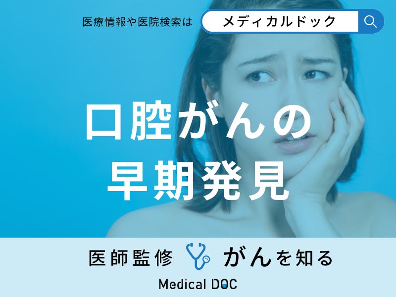 「口腔がんを早期発見」するためのセルフチェック法はご存知ですか？医師が監修！