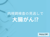 内視鏡検査の“見逃し”で大腸がんに… 「内視鏡後発見大腸がん」の原因・予防法を医師が解説!