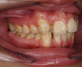 桜新町グリーン歯科・矯正歯科