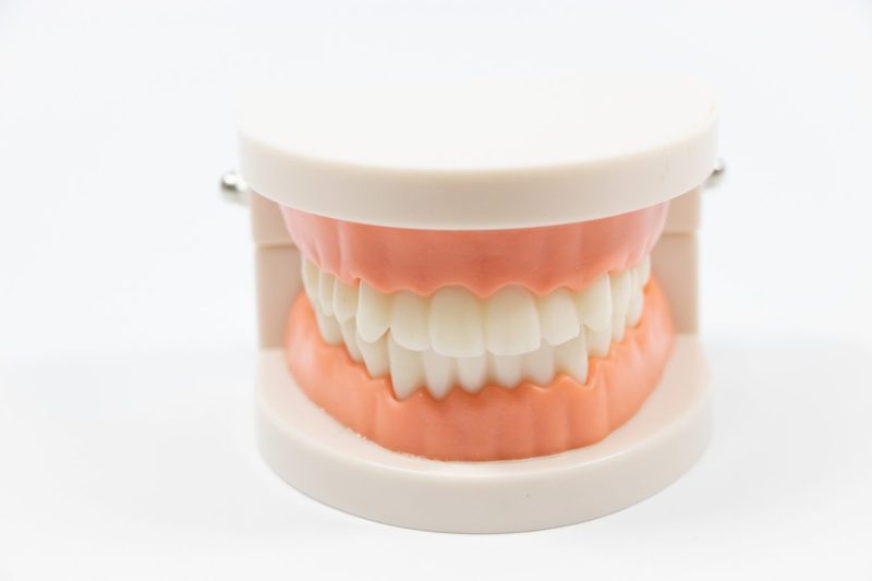 歯模型