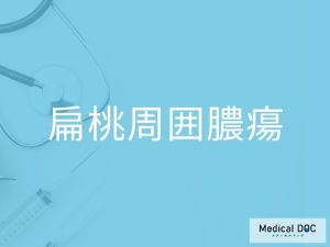 扁桃周囲膿瘍
