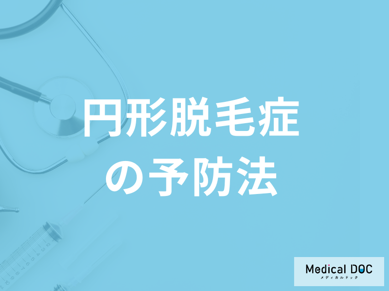 「円形脱毛症を予防」するには毎日何をすれば良いかご存じですか?医師が解説!