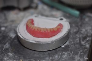 入れ歯は乾燥に注意が必要？正しいお手入れ方法や保管方法、注意点を解説