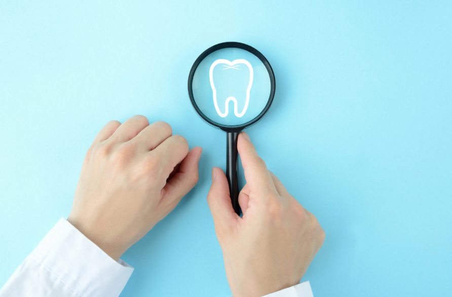 出っ歯はオールオン4で改善できる?治療方法や治療時の注意点について解説します