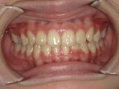 チャイルドしかハウス