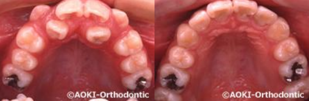 あおき矯正歯科