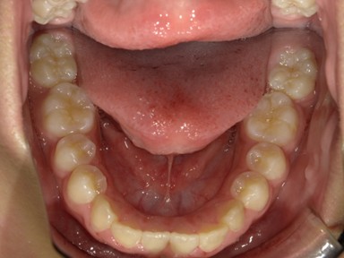 チャイルドしかハウス