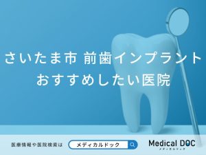 さいたま市 前歯のインプラント治療