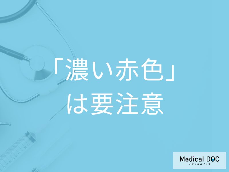 「がん」の可能性がある尿の特徴はご存じですか? 注意すべき血尿を医師が解説!