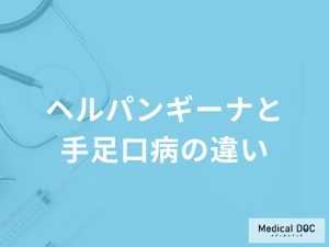 「ヘルパンギーナと手足口病」の症状とその違いとは？発症しやすい年齢層も解説！