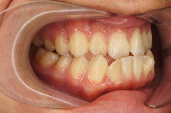 桜新町グリーン歯科・矯正歯科