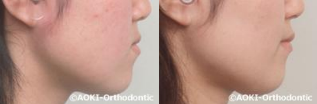 あおき矯正歯科