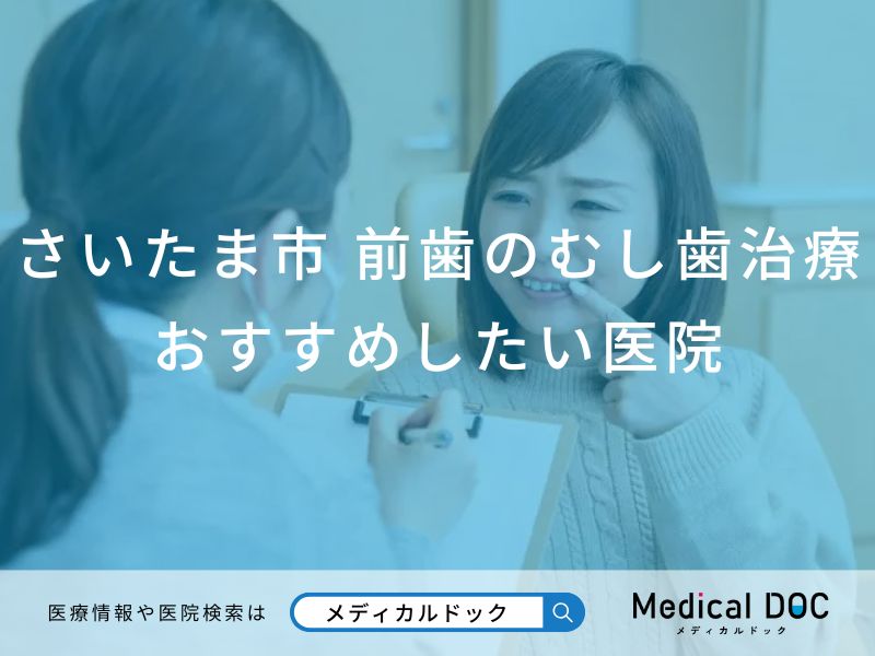 さいたま市 前歯の虫歯治療