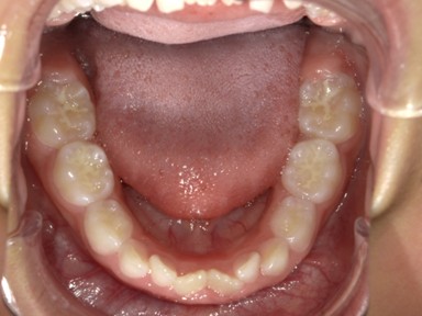 チャイルドしかハウス