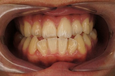 桜新町グリーン歯科・矯正歯科