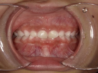 チャイルドしかハウス