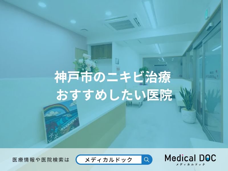 神戸市のニキビ治療 おすすめしたい医院