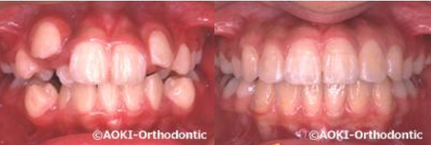 あおき矯正歯科