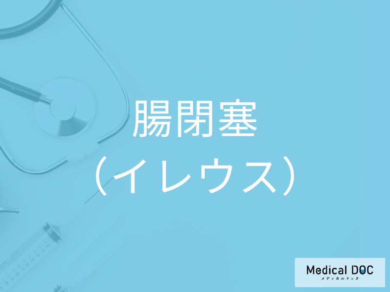 腸閉塞（イレウス）