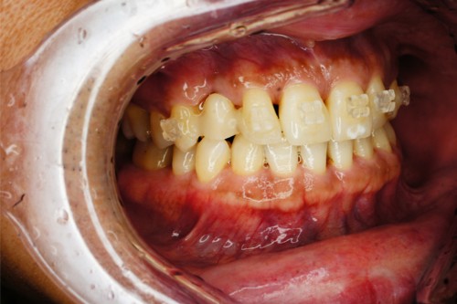 桜新町グリーン歯科・矯正歯科