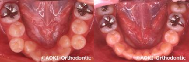 あおき矯正歯科