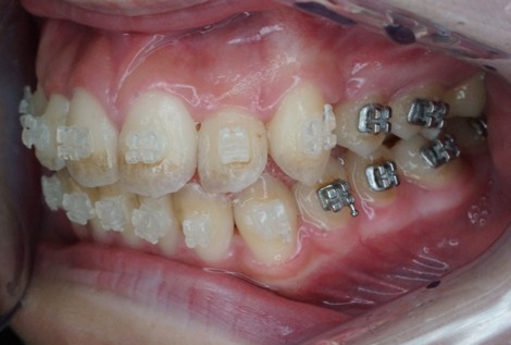 登戸クローバー歯科・矯正歯科