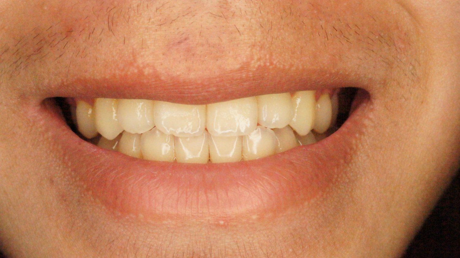 桜新町グリーン歯科・矯正歯科