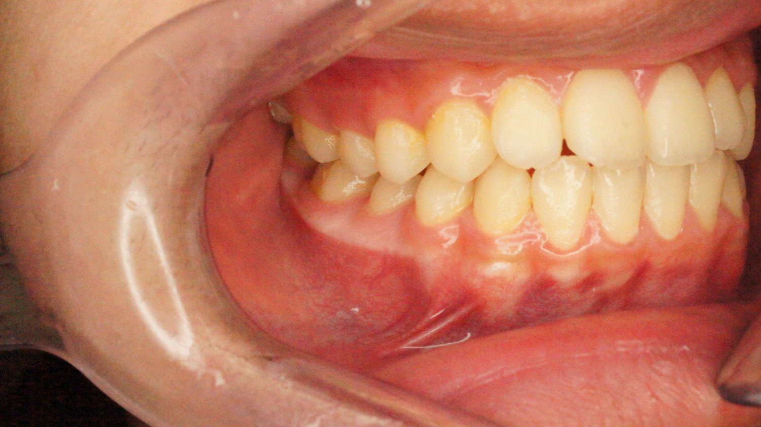 桜新町グリーン歯科・矯正歯科