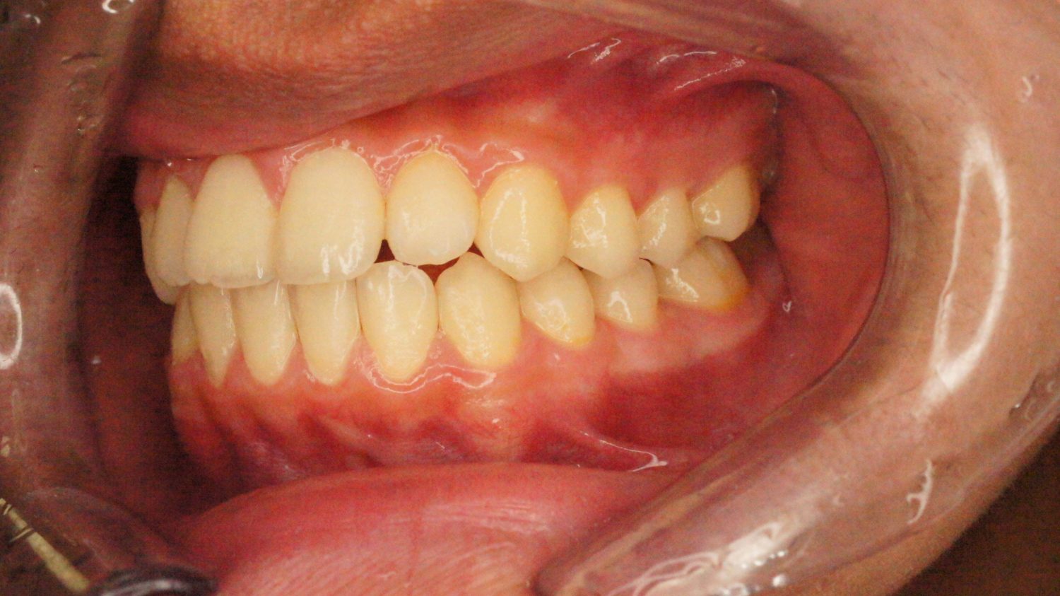 桜新町グリーン歯科・矯正歯科