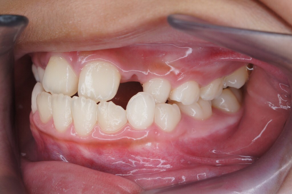 桜新町グリーン歯科・矯正歯科