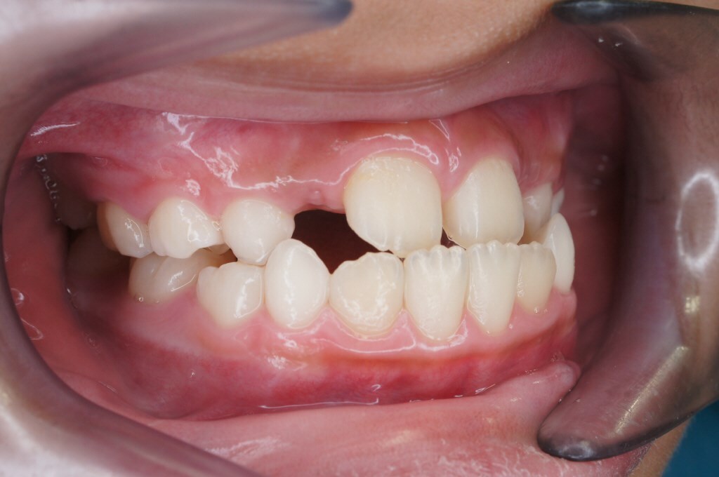 桜新町グリーン歯科・矯正歯科