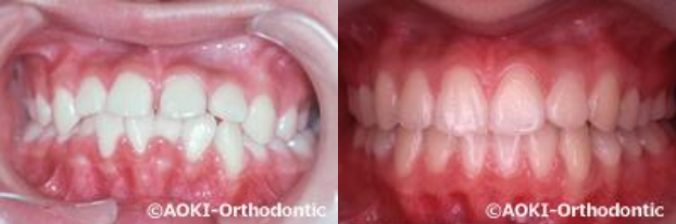 あおき矯正歯科