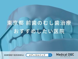東京都 前歯の虫歯治療